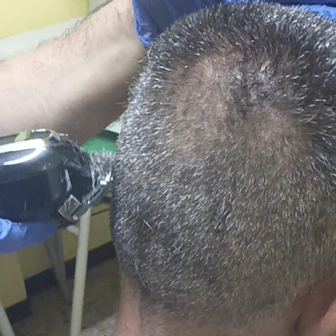 “Tagliamo i capelli a chi non può permetterselo, specie d’estate”: ecco l’iniziativa benefica dei volontari dell’Ambulatorio popolare – VIDEO