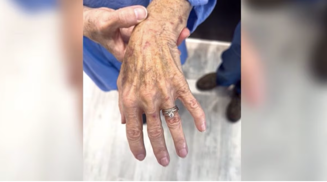 “Lo abbiamo raccolto, ci siamo guardati e ci siamo detti: ‘Cosa ne facciamo?'”: ritrova nel water l’anello di fidanzamento perso 10 anni prima, l’incredibile scoperta degli idraulici