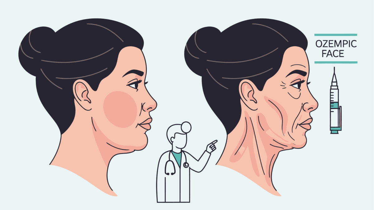 “Guance infossate, pelle flaccida, occhi sporgenti: il viso si svuota in modo innaturale ed è molto difficile recuperare tonicità”: così l'”Ozempic Face” sta cambiando i protocolli di medicina estetica
