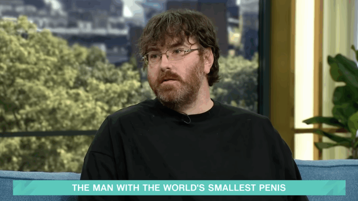 “Il mio pene è il più piccolo del mondo e misura 1 centimetro, adesso posso fare l’operazione per ingrandirlo”: la storia di Michael Phillips
