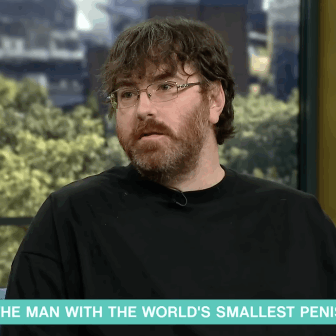 “Il mio pene è il più piccolo del mondo e misura 1 centimetro, adesso posso fare l’operazione per ingrandirlo”: la storia di Michael Phillips