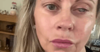 Copertina di “Un parassita ha divorato il mio occhio, la cornea e tutti i miei nervi. E’ stato un dolore lancinante. I medici non riuscivano a credere alla velocità con cui ha agito”: la storia di Emma Marsden