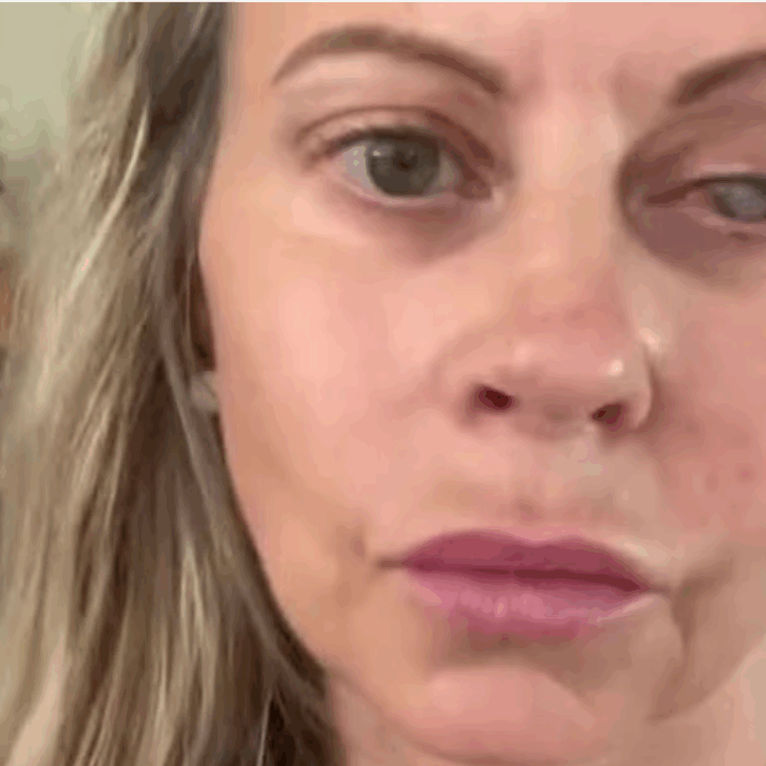 “Un parassita ha divorato il mio occhio, la cornea e tutti i miei nervi. E’ stato un dolore lancinante. I medici non riuscivano a credere alla velocità con cui ha agito”: la storia di Emma Marsden