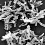 Copertina di Clostridium difficile, cos’è il batterio sospettato per la morte di un bimbo a Catanzaro: come si trasmette, i sintomi e le cure
