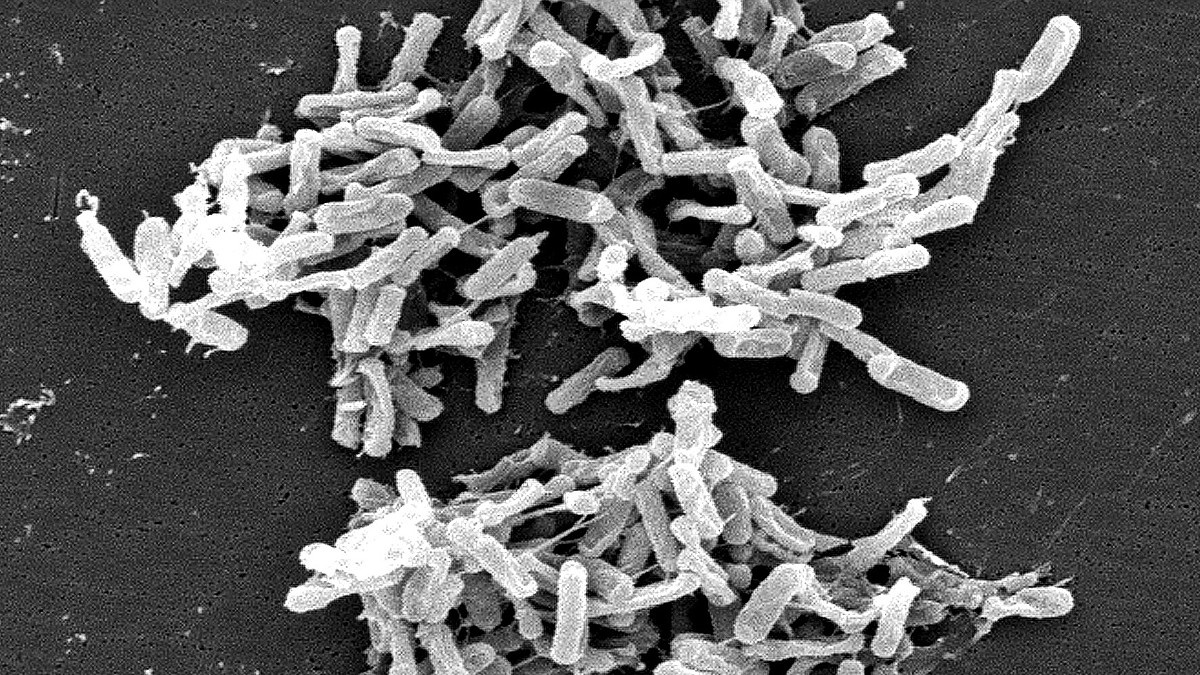 clostridium difficile cos8217232 il batterio sospettato per la morte di un bimbo a catanzaro come si trasmette i sintomi e le cure da Ilfattoquotidiano.it clostridium difficile cos8217232 il batterio sospettato per la morte di un bimbo a catanzaro come si trasmette i sintomi e le cure