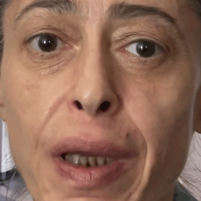 “Ho sentito un dolorino. Dopo una visita e una Tac è emerso che ho una cisti alla gola, che preme sulle corde vocali. Devo essere operata d’urgenza”: così Gerardina Trovato