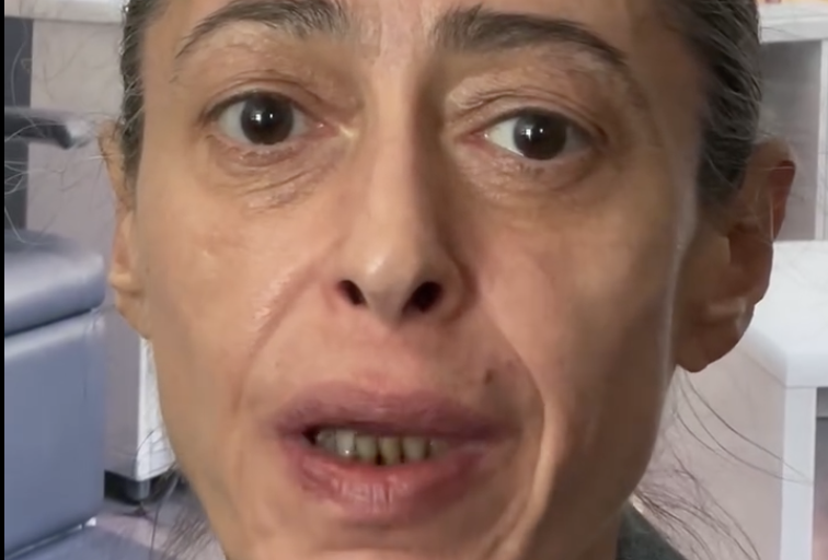 ho sentito un dolorino dopo una visita e una tac 232 emerso che ho una cisti alla gola che preme sulle corde vocali devo essere operata d8217urgenza cos236 gerardina trovato da Ilfattoquotidiano.it ho sentito un dolorino dopo una visita e una tac 232 emerso che ho una cisti alla gola che preme sulle corde vocali devo essere operata d8217urgenza cos236 gerardina trovato