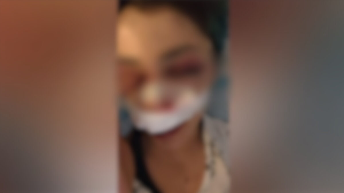 bari 26enne aggredita da dieci ragazzini i soccorsi li ho chiamati io da Ilfattoquotidiano.it bari 26enne aggredita da dieci ragazzini i soccorsi li ho chiamati io