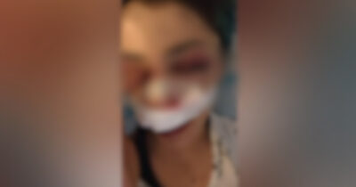 Copertina di Bari, 26enne aggredita da dieci ragazzini. “I soccorsi li ho chiamati io”