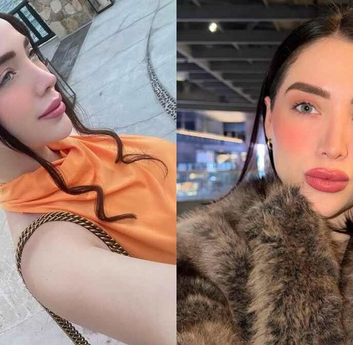 È morta a 30 anni l’influencer Adriana Garcia dopo un intervento di chirurgia estetica: indagini in corso