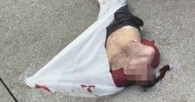 Copertina di Fakir, nuovo video: c’è sangue sul volto e pure sotto la nuca