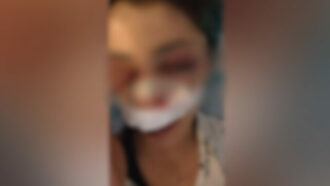 Copertina di Picchiata dal branco nel parco di Bari, sotto inchiesta l’addetta ai bagni e il compagno