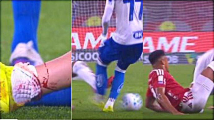 Spacca la tibia all’avversario, viene squalificato fino a quando il calciatore non tornerà in campo: la clamorosa sentenza