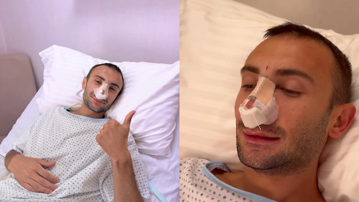 “Finalmente ho fatto l’intervento di chirurgia al naso. Potete criticarmi quanto volete, ma il mio volermi bene va sopra tutto”: parla Ramon, il ballerino di Amici
