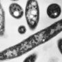 Copertina di Focolaio di legionella a Basilea, un morto 26 casi: “Verifiche su torri di raffreddamento per uffici”
