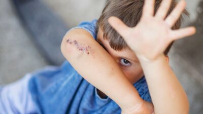 Copertina di Brianza, abusi su bimbi: arrestate due maestre