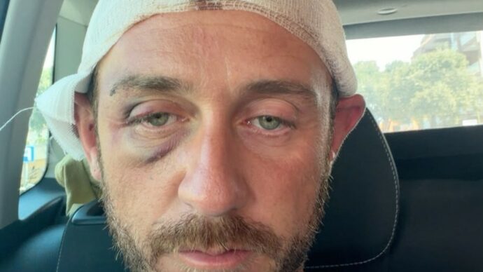 In 30 contro 1 dopo una serata a Olbia: “Vattene via fr…io”. Il racconto del 39enne aggredito: “Ragazzini come marionette, un papà mi ha minacciato perché non volevo ritirare la denuncia”
