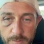 Copertina di In 30 contro 1 dopo una serata a Olbia: “Vattene via fr…io”. Il racconto del 39enne aggredito: “Ragazzini come marionette seguono pensieri e azioni più grandi di loro”