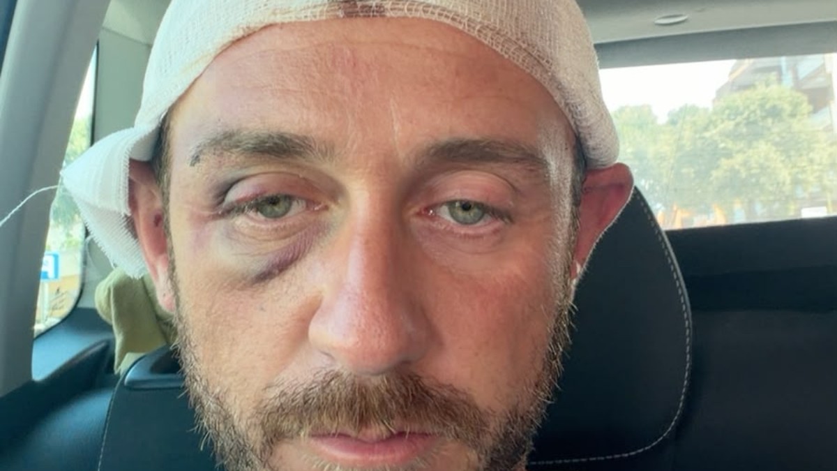 in 30 contro 1 dopo una serata a olbia vattene via fr8230io il racconto del 39enne aggredito ragazzini come marionette seguono pensieri e azioni pi249 grandi di loro da Ilfattoquotidiano.it in 30 contro 1 dopo una serata a olbia vattene via fr8230io il racconto del 39enne aggredito ragazzini come marionette seguono pensieri e azioni pi249 grandi di loro