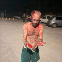 In 30 contro 1 dopo una serata a Olbia: “Vattene via fr…io”. Il racconto del 39enne aggredito: “Ragazzini come marionette seguono pensieri e azioni più grandi di loro”