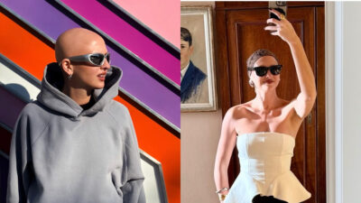 Copertina di “Ho l’alopecia, ma non ho mai indossato parrucche. Dopo l’adolescenza ho sentito la necessità di mostrarmi”: la storia di Eugenia Longo
