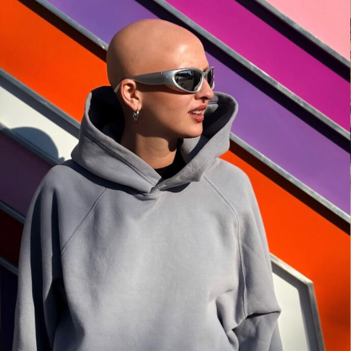 “Ho l’alopecia, ma non ho mai indossato parrucche. Dopo l’adolescenza ho sentito la necessità di mostrarmi”: la storia di Eugenia Longo