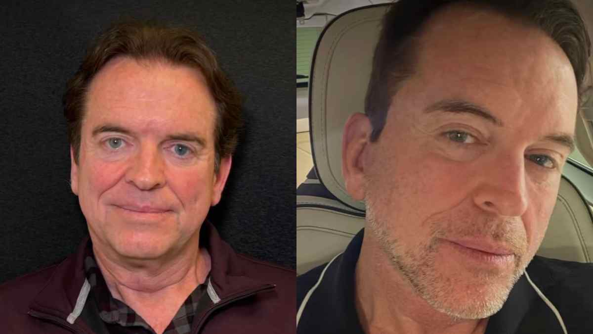 “Ho fatto un lifting a 59 anni. La pelle degli uomini è più pesante, è più spessa, presenta peli: l’operazione è durata otto ore ma oggi mi sento me stesso”. La storia di Jeff