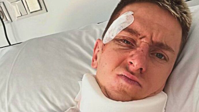 La foto di Pogacar dall’ospedale dopo la caduta: deve operarsi, stagione a rischio. Come sta