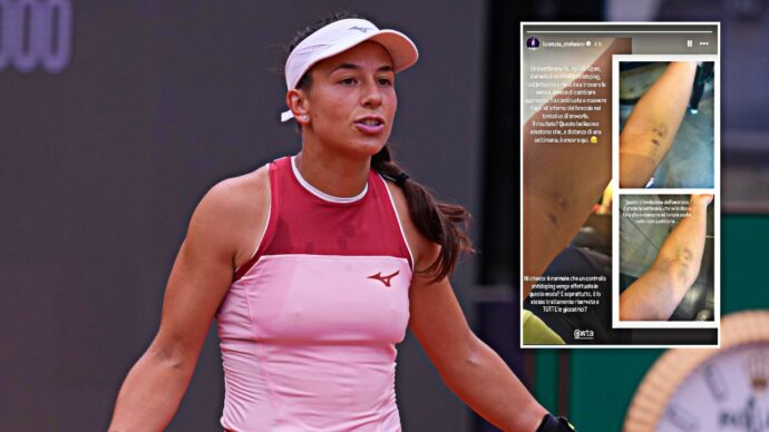 Us Open, Stefanini mostra un livido sul braccio: “Colpa di un controllo antidoping, non trovavano la vena e muovevano l’ago. Stesso trattamento per tutte?”