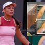 Copertina di Us Open, Stefanini mostra un livido sul braccio: “Colpa di un controllo antidoping, non trovavano la vena e muovevano l’ago. Stesso trattamento per tutte?”