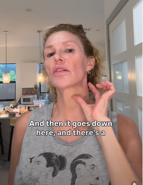 “Ho un parassita che mi cammina nella faccia, ora scende anche lungo il braccio. È duro come la roccia e si curva così. Ne sono così nauseata che vorrei solo tagliarlo via”: lo sfogo di Brandi Glanville