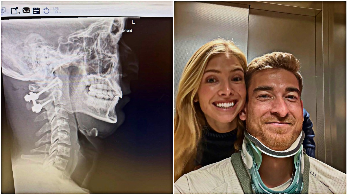ho rischiato di non camminare pi249 non riuscivo a muovere il collo ora ho quattro viti cos236 klinsmann jr da Ilfattoquotidiano.it ho rischiato di non camminare pi249 non riuscivo a muovere il collo ora ho quattro viti cos236 klinsmann jr