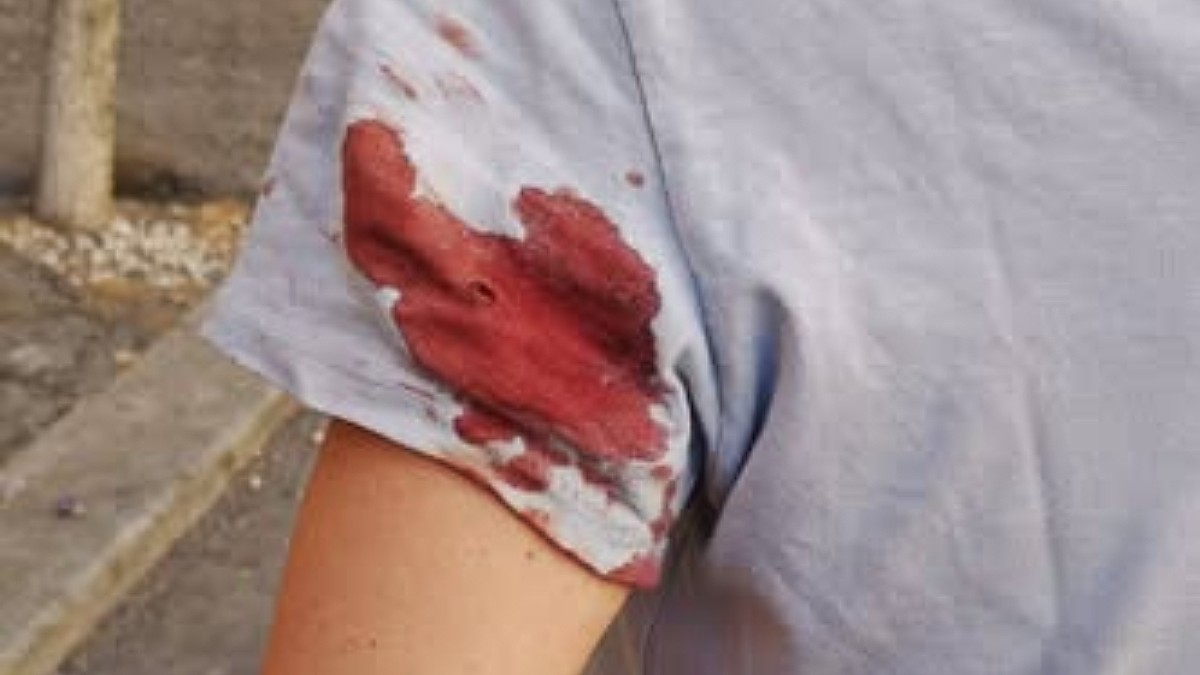 donna ferita al braccio da un colpo ad aria compressa in strada in zona prati roma il racconto sui social segnalazioni di altri episodi contro donne e turiste da Ilfattoquotidiano.it donna ferita al braccio da un colpo ad aria compressa in strada in zona prati roma il racconto sui social segnalazioni di altri episodi contro donne e turiste