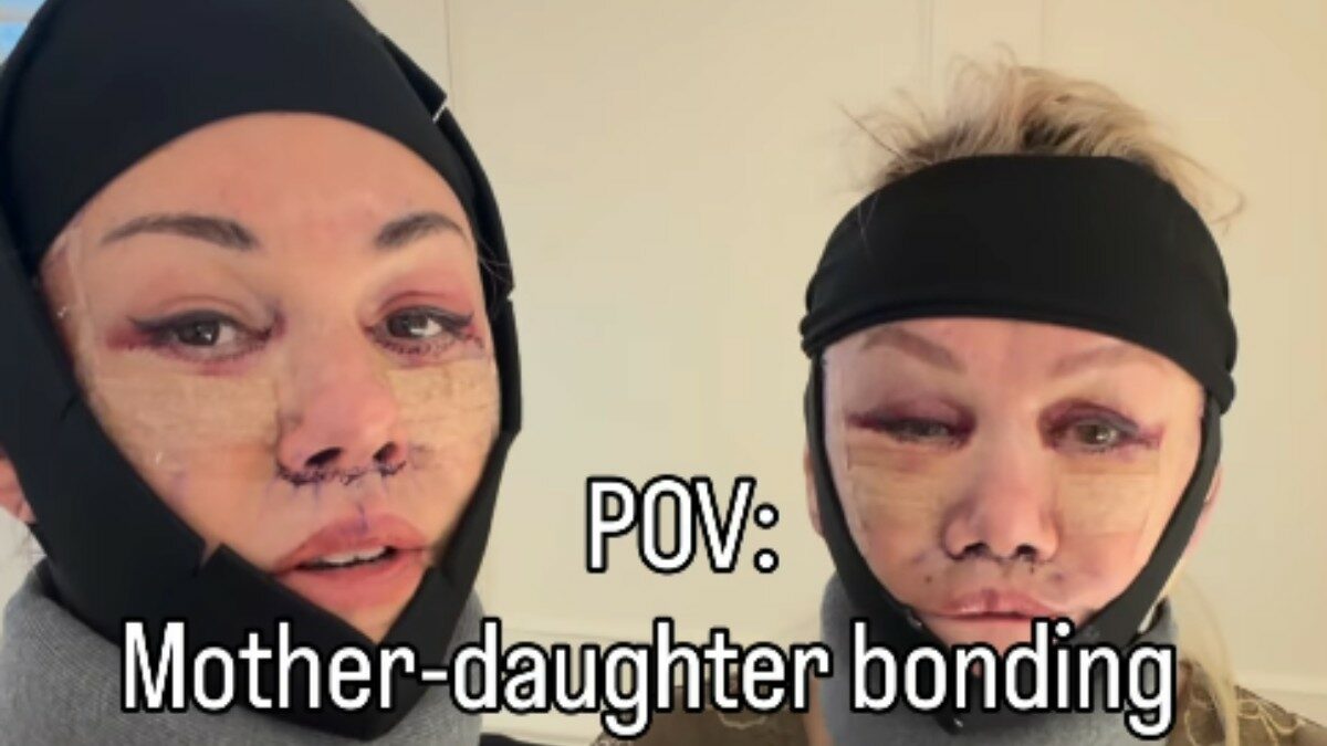 “Ci criticano perché abbiamo fatto un lifting insieme? Non mi interessano le opinioni degli sconosciuti. E ci ha semplificato la vita”: mamma e figlia volano in Corea del Sud per rifarsi il viso