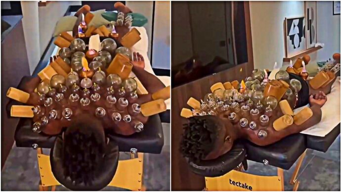 Onana e il trattamento con le candele accese sulla schiena: il video dell’ex Inter diventa virale. A cosa serve