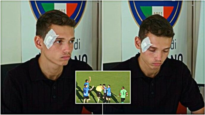 Arbitro 19enne colpito da un sasso durante una partita: follia in Campania. La vittima: “Torno presto in campo”
