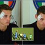 Copertina di Arbitro 19enne colpito da un sasso durante una partita: follia in Campania. La vittima: “Torno presto in campo”
