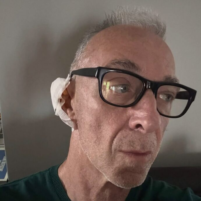 “Mi vedrete così, in stile Van Gogh. La causa si chiama epitelioma, una cosa molto comune ma da non sottovalutare”: Linus e la medicazione all’orecchio