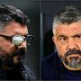 Copertina di “Da 15 anni faccio uso di cortisone, c’è gente con la mia stessa malattia che sta 4-5 mesi a letto, non riesce a muoversi”: la rivelazione di Gattuso