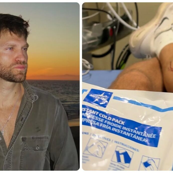 “Dio ha detto, ‘no stasera’. La mia vita appesa a un orologio”: Keegan Allen aggredito in strada per rapina
