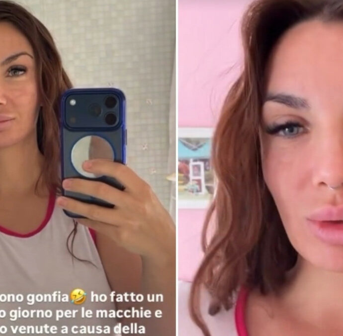 “Se mi vedete gonfia, sono gonfia. Ho fatto un laser bello forte per le macchie e i brufoli che mi sono venuti con la pillola anticoncezionale”: Elettra Lamborghini racconta la sua esperienza