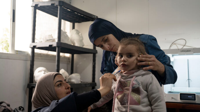 Gaza, la denuncia di Msf: “Non possiamo più produrre le maschere per i bambini ustionati a causa del blocco di Israele”